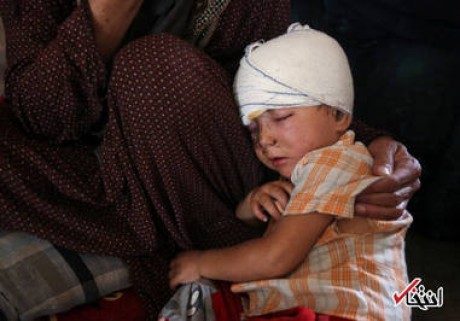 زخم جنگ بر سر و صورت کودکان عراقی+عکس