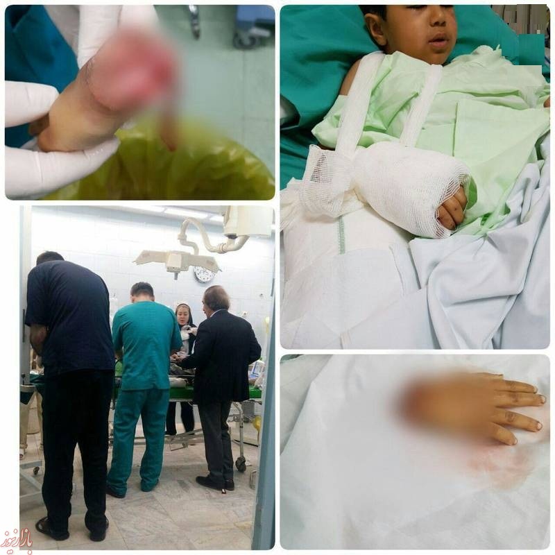 عکس: پیوند دست قطع شده کودک زلزله‌زده کرمانشاهی (16+)